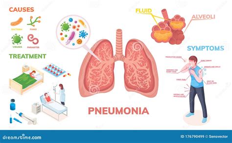 Pneumonia Chain Of Infection