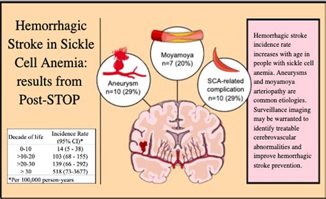 Incidence Of Hemorrhagic Stroke In Patients With Sickle Cell Disease