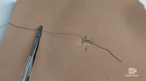 Hd Figure Of 8 Suture Emrap