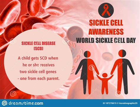 World Sickle Cell Day ‘bone Marrow Transplant Best Option For Sickle