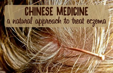 Traditional Chinese Medicine Approach To Eczema