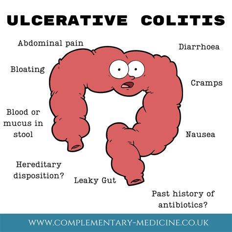 Ulcerative Colitis Complementary Medicine Clinic