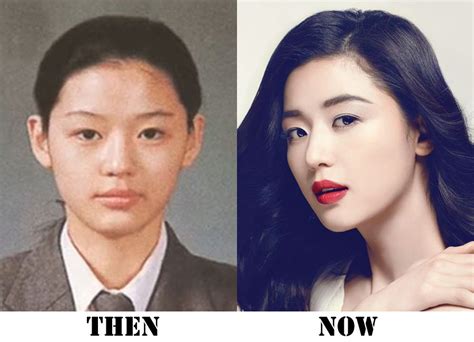 Plastic Surgery Before And After Korean Celebrities