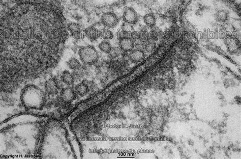 Synapse Drjastrows Electron Microscopic Atlas