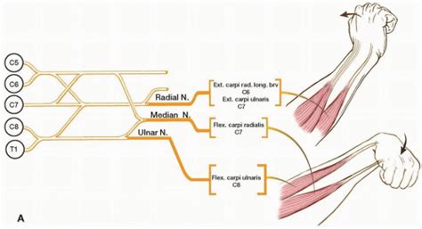 Evaluation Of Nerve Root Lesions Involving The Upper Extremity Neupsy Key