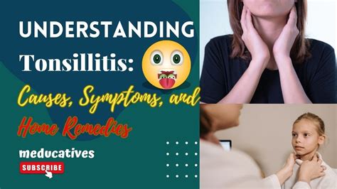 Understanding Tonsillitis Tonsils Causes Symptoms And Home