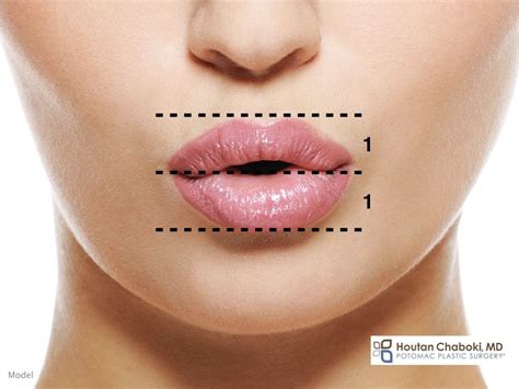 the ideal lip shape in plastic surgery