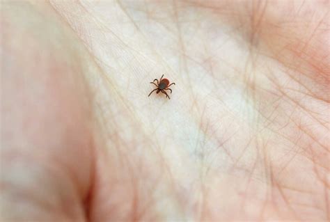 Dont Panic If You Get Bit By A Tick Here Are 5 Tips To Minimize Lyme