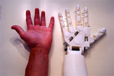 Diy Prosthetic Hand And Forearm Voice Controlled 14 Steps With