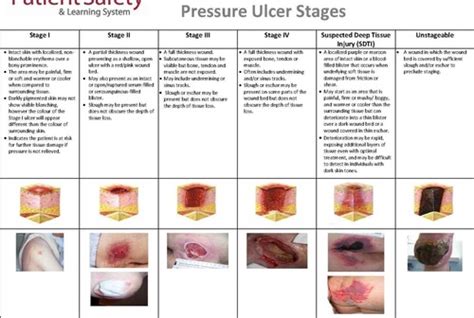 Pressure Ulcers Flashcards Quizlet