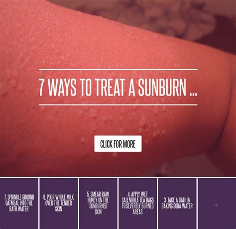 Ways To Treat A Sunburn Skincare
