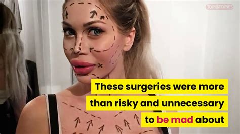 Ribs Removed Over Surgeries To Become A Living Cartoon Meet