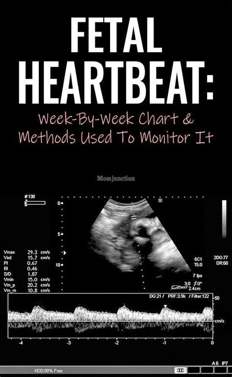 Fetal Heartbeat Week By Week Chart And Methods Used To Monitor It My Xxx Hot Girl