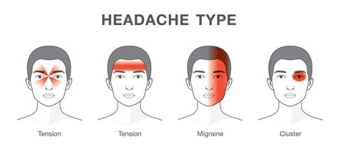 Headache Treatment And Migraine Cures Guide Learn The Facts