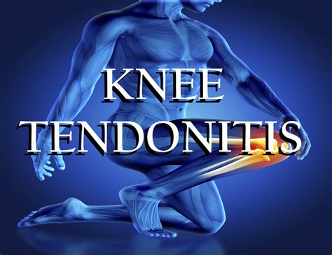 What Is Tendonitis Of The Knee