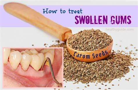 34 Tips How To Treat Swollen Gums Around Tooth And Cheek Fast