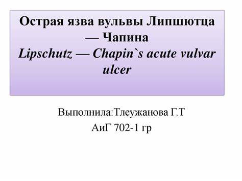 Острая язва диета Острая язва вульвы - презентация онлайн Острая язва вульвы - презентация онлайн Острая язва диета