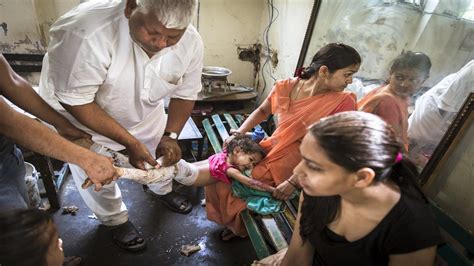 In India A Homemade Remedy For Burn Victims