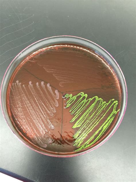 Emb Agar Plate Microbiología Bioquímica Farmacia