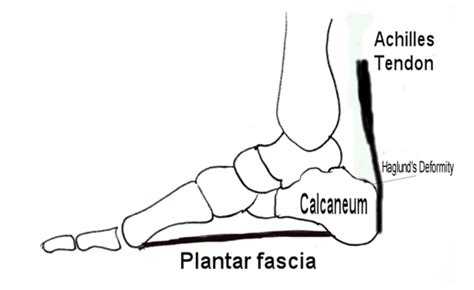 O tendon fascicles appear as alternate hypoechogenic and hyperechogenic. Achilles Tendon - Cambridge Foot and Ankle Clinic