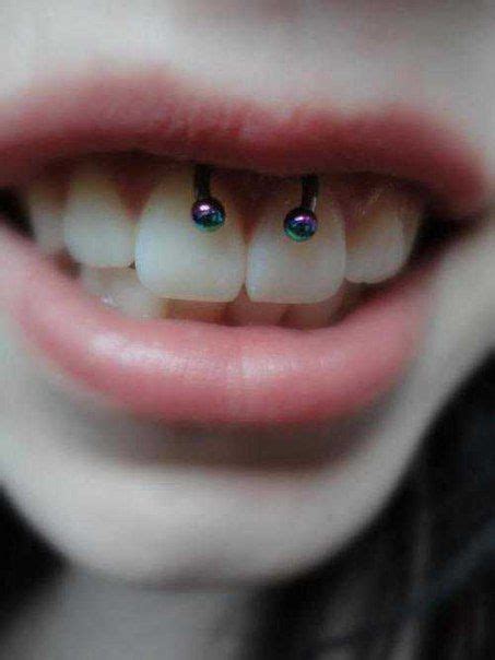 Smiley Piercing Amazing Photos And Important Information Tats N Rings