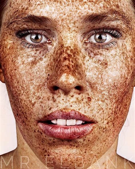 Unique Beauty Of Freckled People Documented By Brock Elbank Freckle Juice Redhead Day
