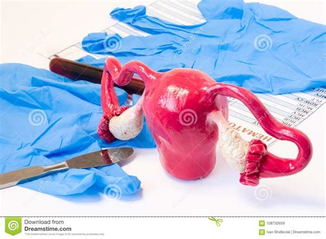 Uterus And Ovaries Genital Female Surgery Concept Model Of Uterus And