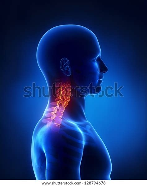 Cervical Spine Lateral View Stock Illustration 128794678 Shutterstock