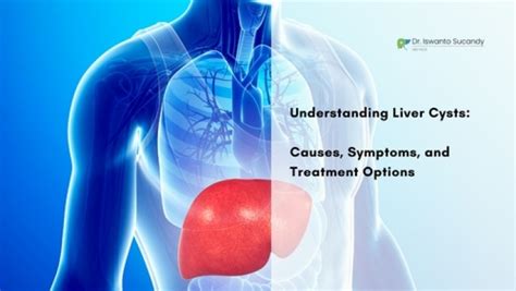 Understanding Liver Cysts Causes Symptoms And Treatment Option