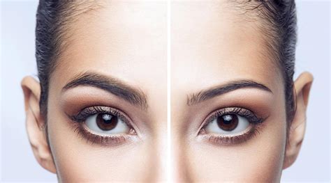 Thinning Eyebrows And The Treatments That Can Help