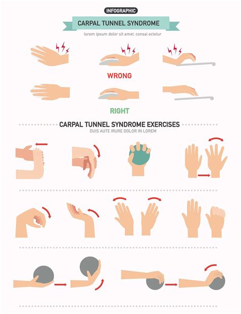 Ecercise Therapy Carpal Tunnel Syndrome Copy