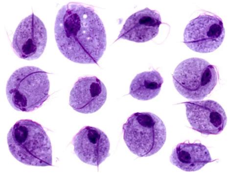 Lab Diagnosis Of Trichomonas Vaginalis Infections Microbe Online