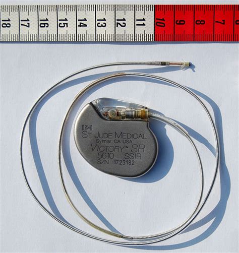 Artificial Pacemaker Wikidoc