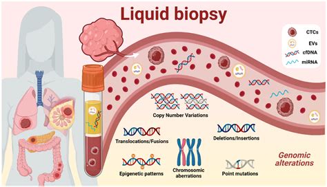 Liquid Biopsy Market 2023 Technology Advancements And Research Saga Diagnostics Ab Circulogene