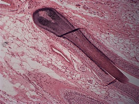 Human Hair Follicle In Microscopic Detail