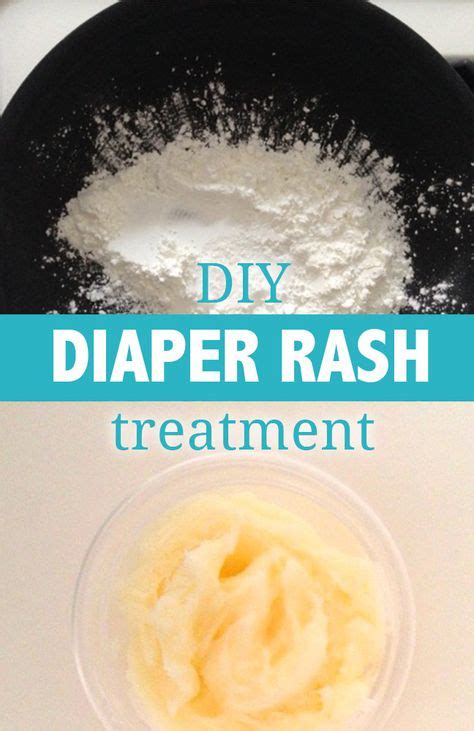 7 Diaper Rash Remedy Ideas Diaper Rash Remedy Diaper Rash Rashes