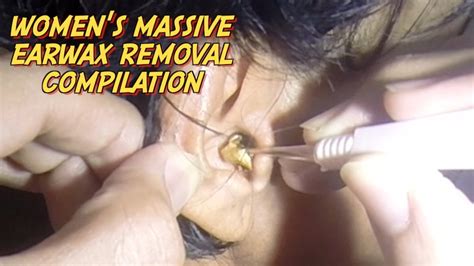 Womens Massive Earwax Removal Compilation Christmas Edition Youtube