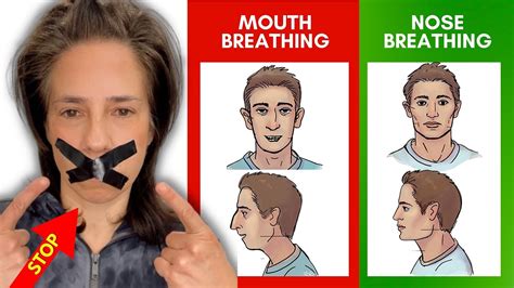 How To Stop Mouth Breathing 👃 😮 Watch This Youtube