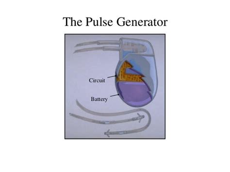 Artificial Cardiac Pacemaker