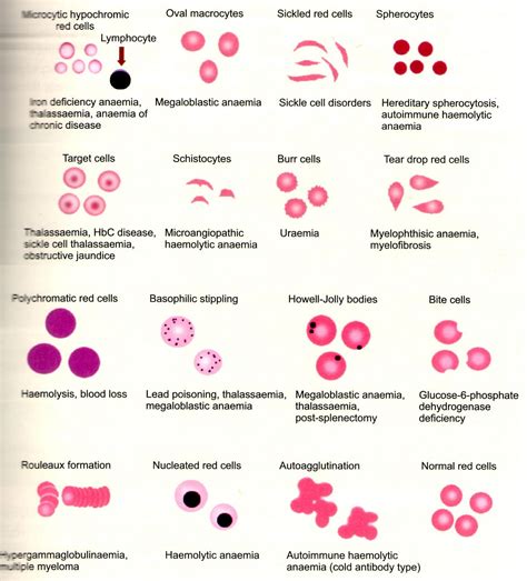 B L O O D Abnormalities Of Red Blood Cells