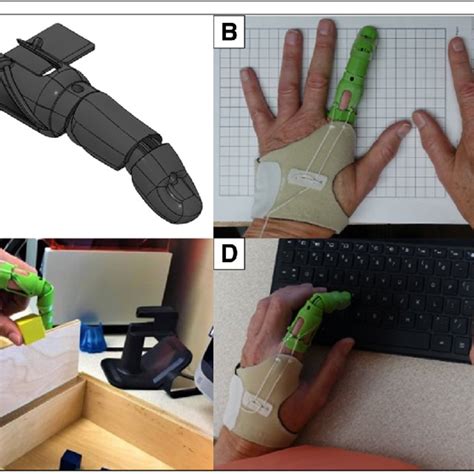 NAKED Prosthetics Inc MCP Driver Finger Prosthesis Download