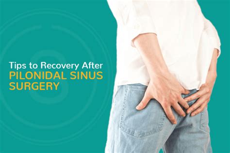 Tips For Recovery After Pilonidal Sinus Surgery Smiles
