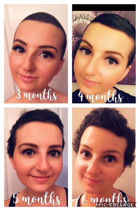 Let It Grow Tips For Post Chemo Hair Growth