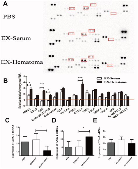 hematoma derived exosomes of chronic subdural hematoma promote abnormal angiogenesis and inhibit
