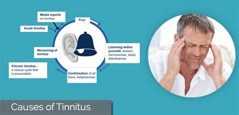 Causes Of Tinnitus New Causes For Ringing In The Ears 2020