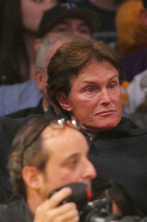 Bruce Jenner Has Second Operation For Skin Cancer