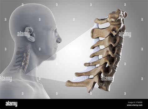 Estilizada Ilustración Mostrando Las Vértebras Del Cuello In Situ Con