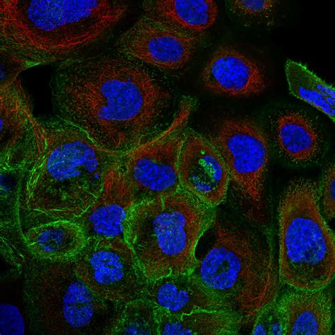 Subcellular Lima The Human Protein Atlas