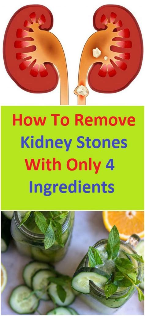How To Cure Kidney Stones Pain