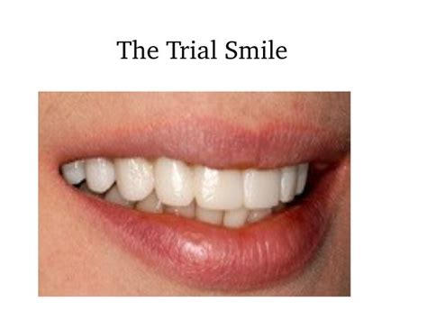 The Best Perfect Smiles Through Cosmetic Dentistry